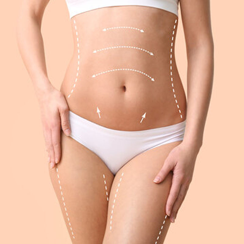 Tummy Tuck and Liposuction