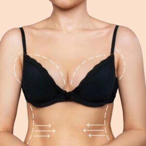 Breast Lift and a Tummy Tuck at the Same Time