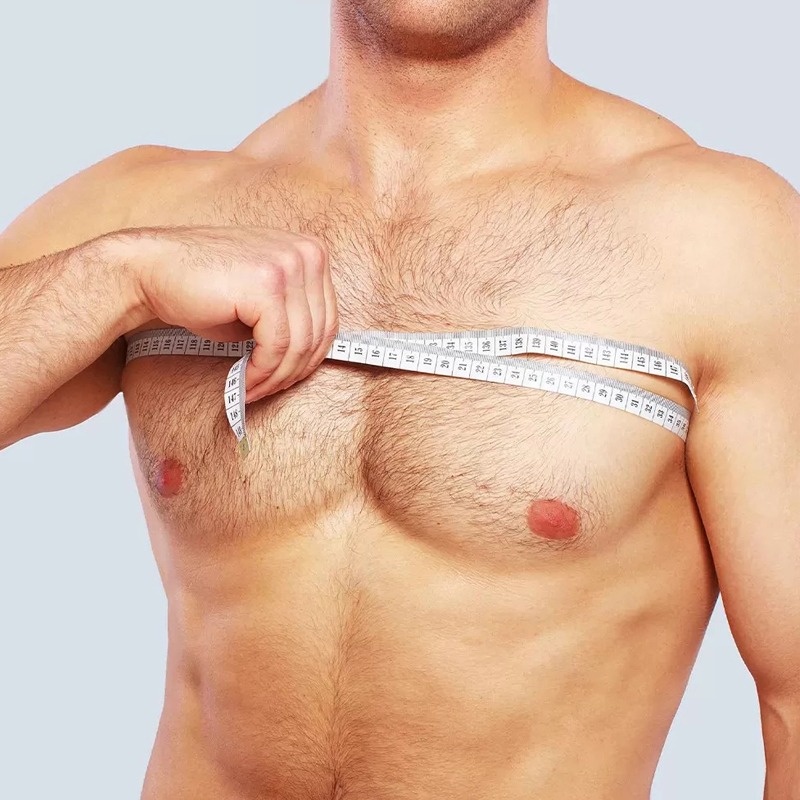 Gynecomastia Surgery Before and After