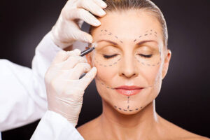 How to Plastic Surgery in Face