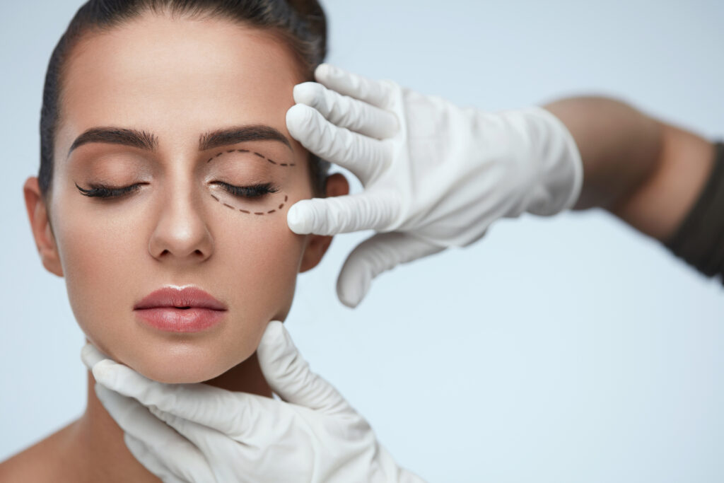 Eye LiftBlepharoplasty