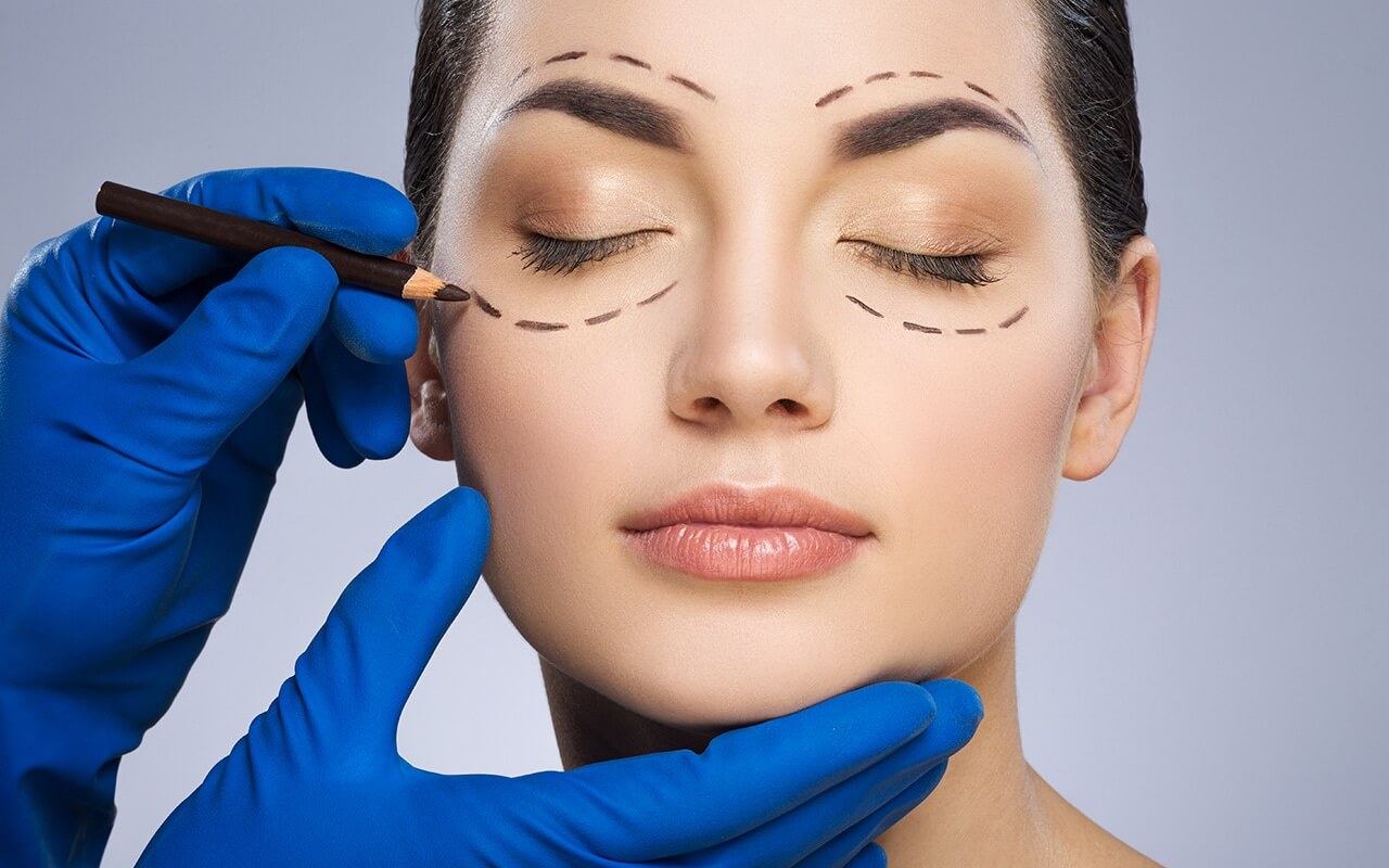 Combined Upper and Lower Blepharoplasty
