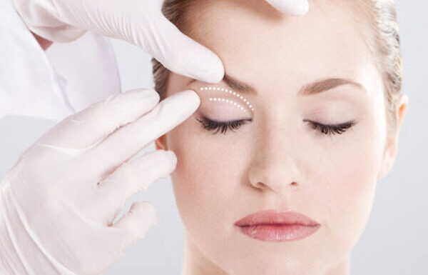 Upper Blepharoplasty