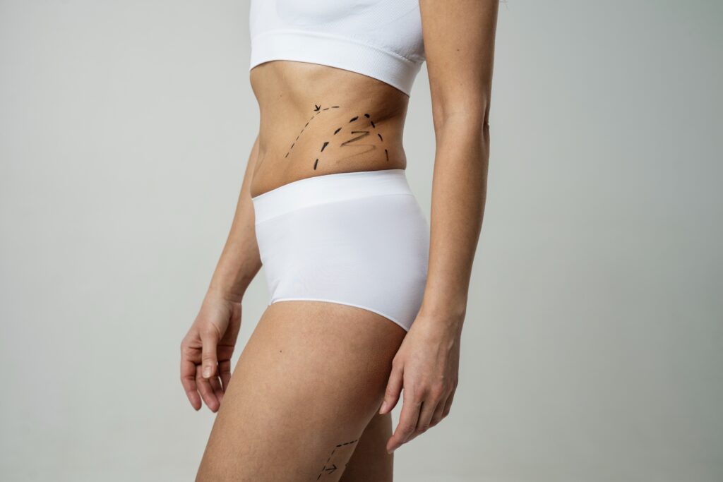 Body contouring surgery at Cocoona Clinic