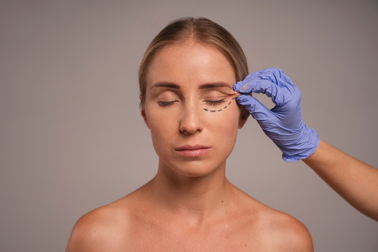 Eye-lift blepharoplasty surgery at Cocoona Clinic