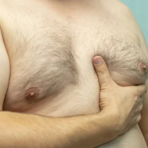 Fat White Middle aged Man With 263658985