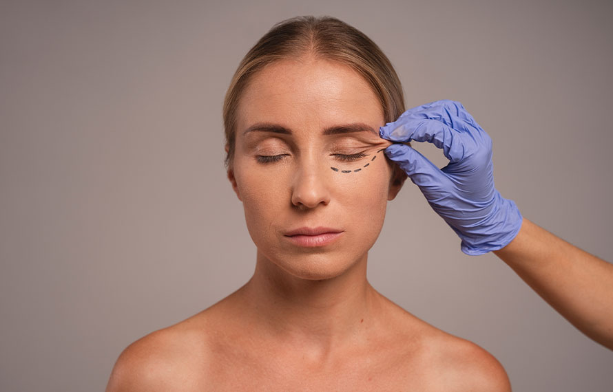 Lower Blepharoplasty 890x570px