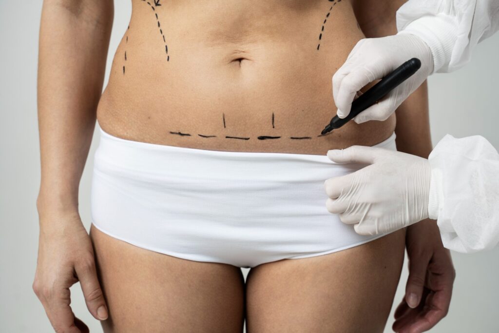 Types of Liposuction Surgery