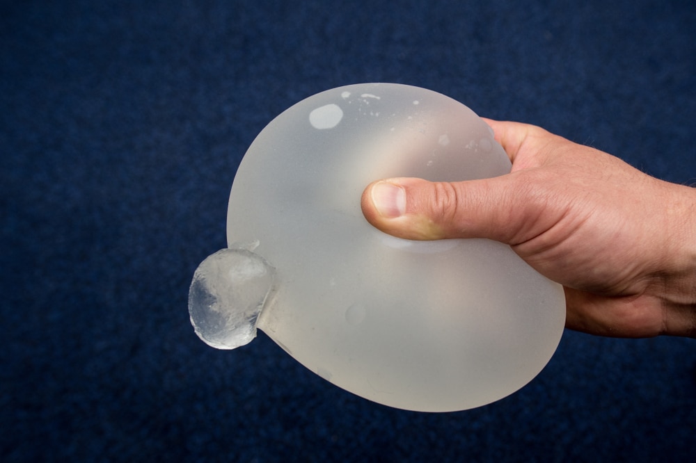Breast implant surgery at Cocoona Clinic