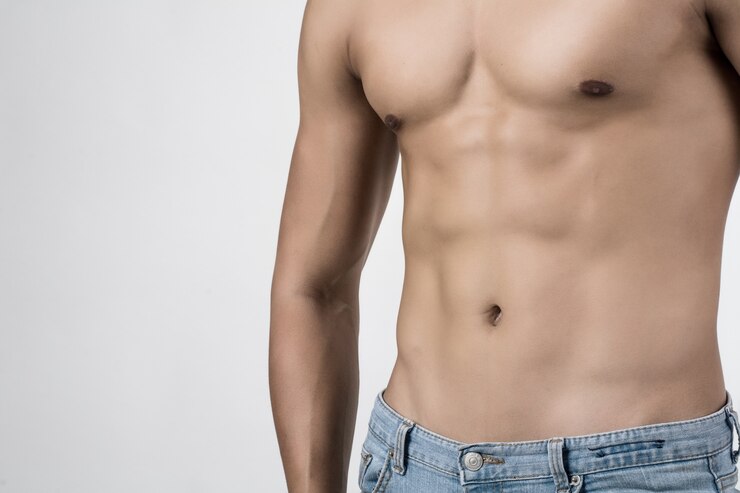 Gynecomastia