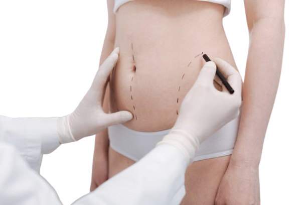 How does liposuction work 1024x683 1