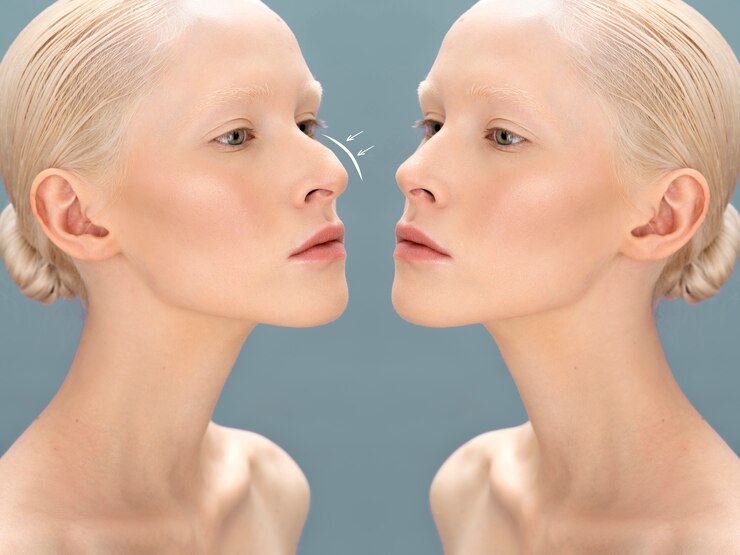 Woman getting ready nose job surgery