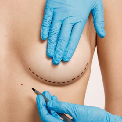 Breast Reduction-slider Breast Reduction Surgery